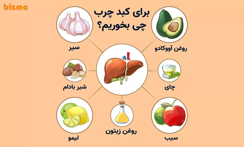 درمان فوری کبد چرب در کمتر از 90 روز! 7 برای درمان کبد چرب چی بخوریم