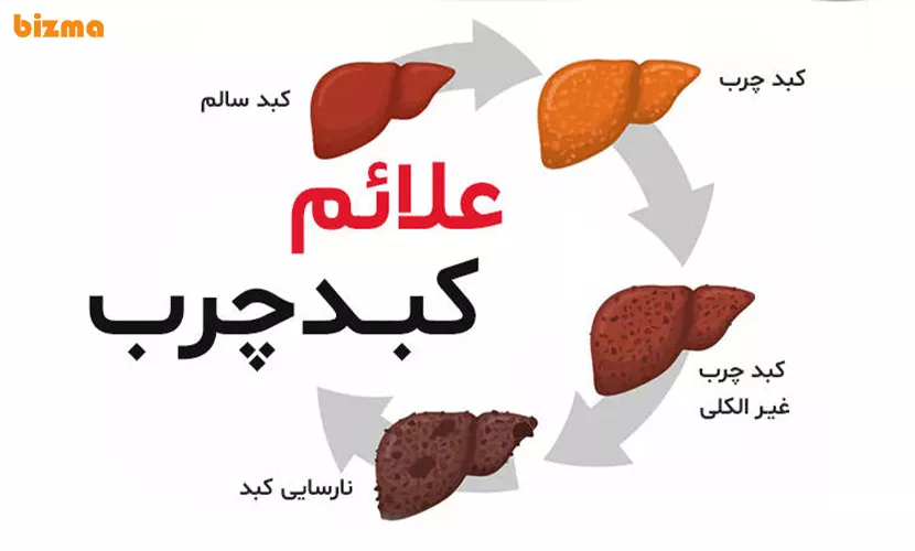 درمان فوری کبد چرب در کمتر از 90 روز! 3 روش تشخیص کبد چرب