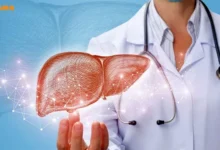 درمان فوری کبد چرب