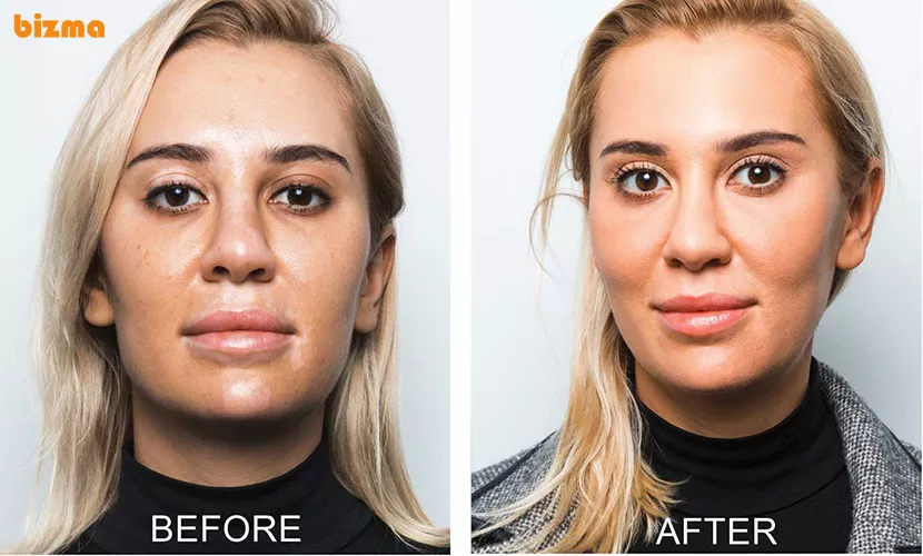 گانودرما برای درمان پیسی