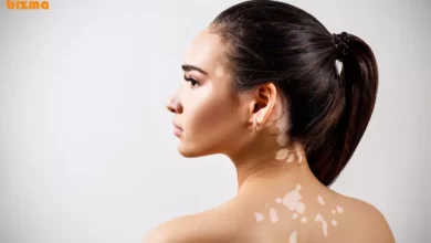 پیسی چیست و چگونه درمان میشود