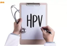 درمان زگیل‌ تناسلی زنان و مردان