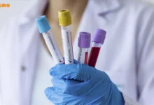 علائم اصلی بیماری کرونا