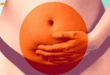 درمان کیست تخمدان؛ علت، علائم و پیشگیری از آن