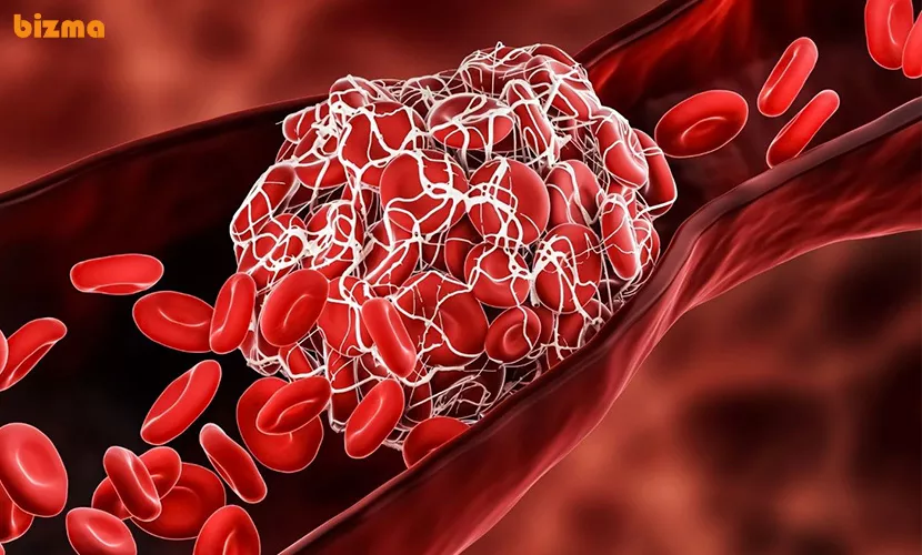 سرطان خون چیست