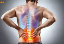 علائم کمر درد و درمان