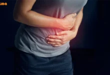 درمان زخم معده با گانودرما