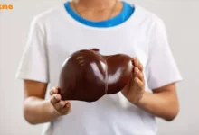 درمان کبد چرب با قهوه گانودرما