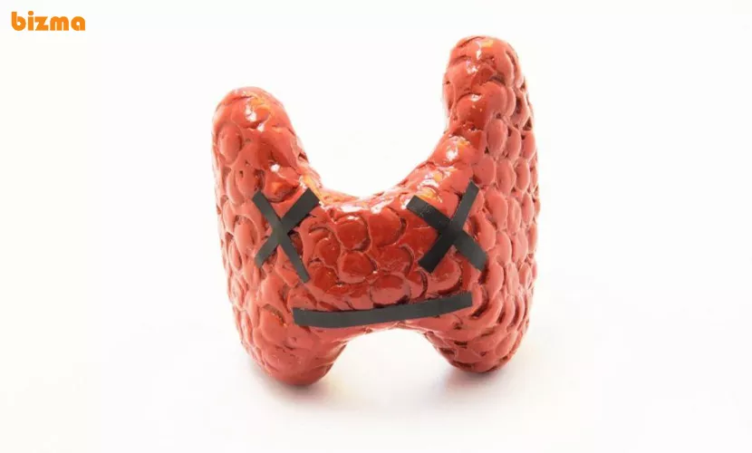 کم کاری تیروئید 