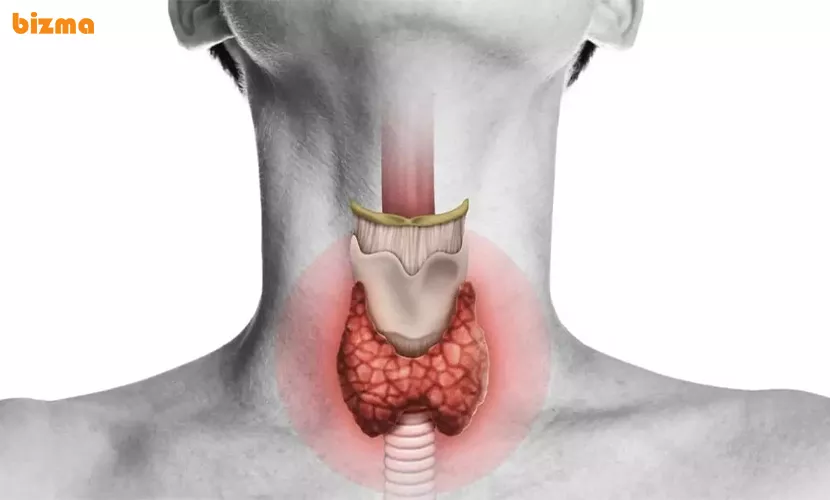 علائم و درمان تیروئید پرکار و کم کار