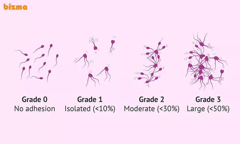 قارچ گانودرما و درمان ناباروری