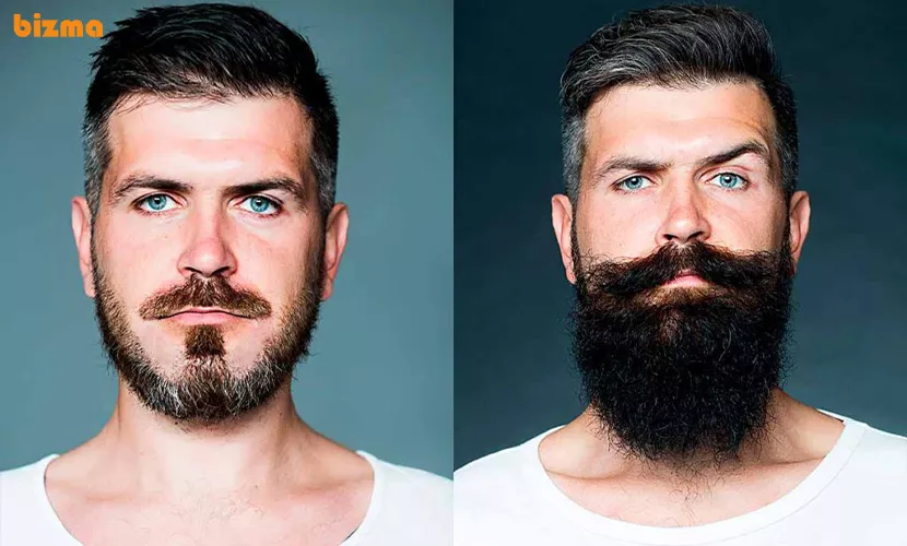 درمان موخوره در ریش مردان