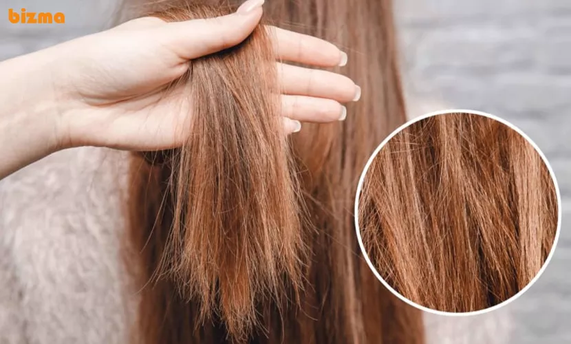 بهترین شامپو برای جلوگیری از موخوره