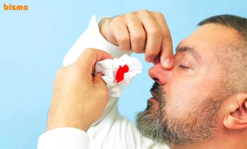 علت خون دماغ شدن