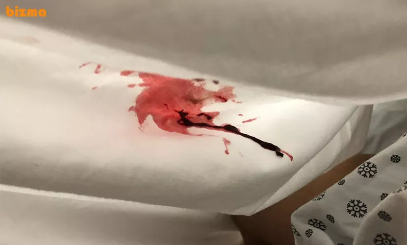 انواع مختلف سرطان خون 