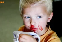 خون دماغ شدن و سرطان؛ چرا خون دماغ می‌شویم!