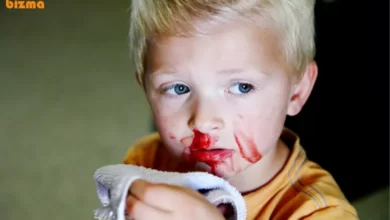 خون دماغ شدن و سرطان؛ چرا خون دماغ می‌شویم!