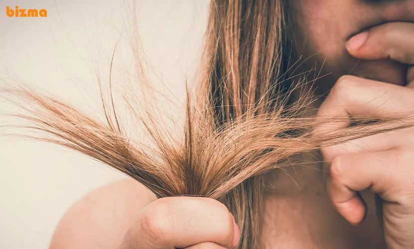 روش‌های پیشگیری و جلوگیری از ایجاد موخوره