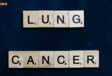 علائم سرطان ریه در زنان