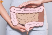 علائم سرطان روده؛ 10 نشانه خاموش در زنان و مردان!