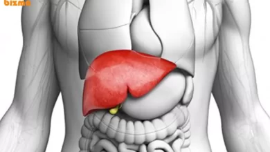 علائم سرطان کبد؛ دلایل، تشخیص و درمان