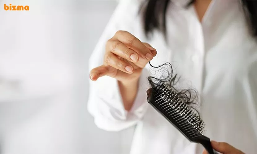 علت ریزش موی شدید و ناگهانی در زنان و مردان