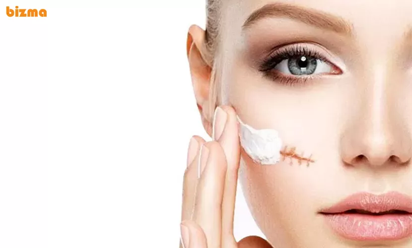 بهترین کرم ترمیم کننده برای زخم و سوختگی