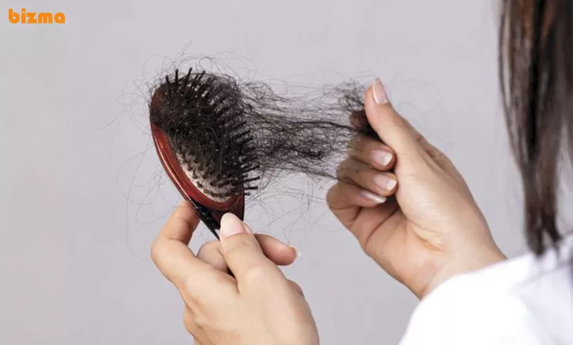 جلوگیری از شوره سر