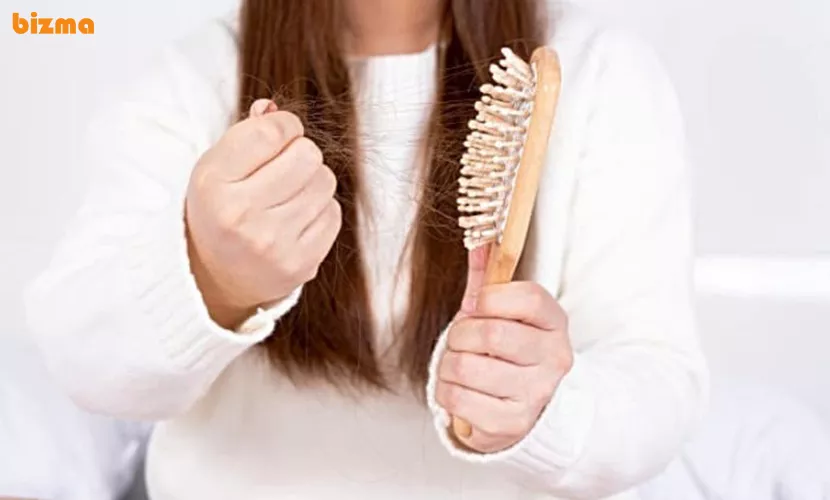 عوامل ریزش مو و شوره سر