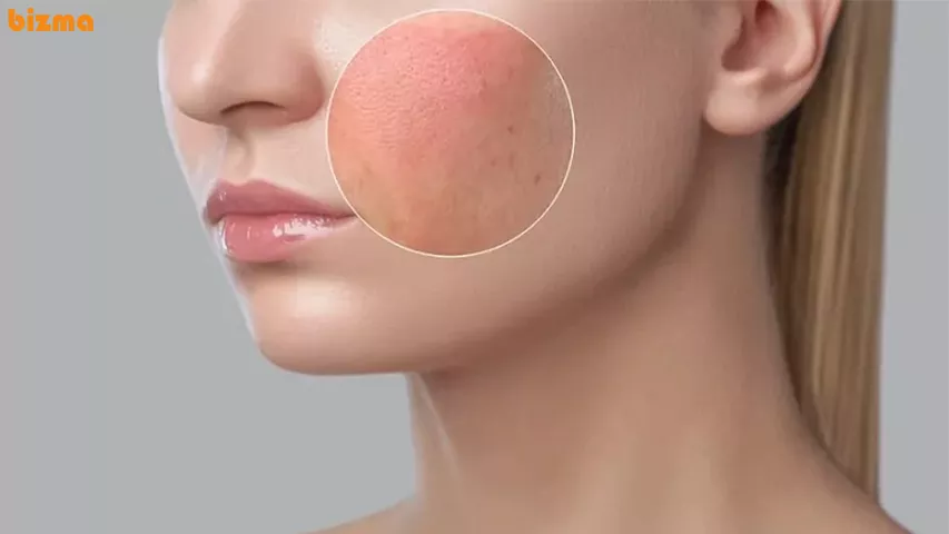 کرم روشن کننده و سفید کننده بدن گاتیو نی نی سایت