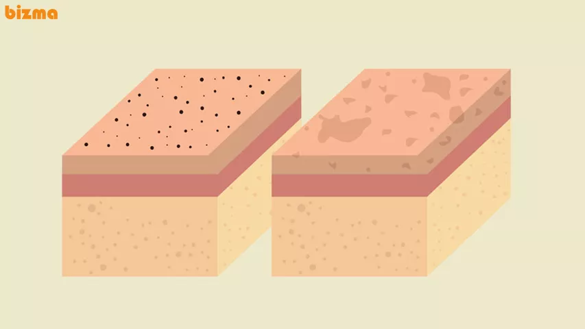 عوارض کرم های گاتیو رفع تیرگی