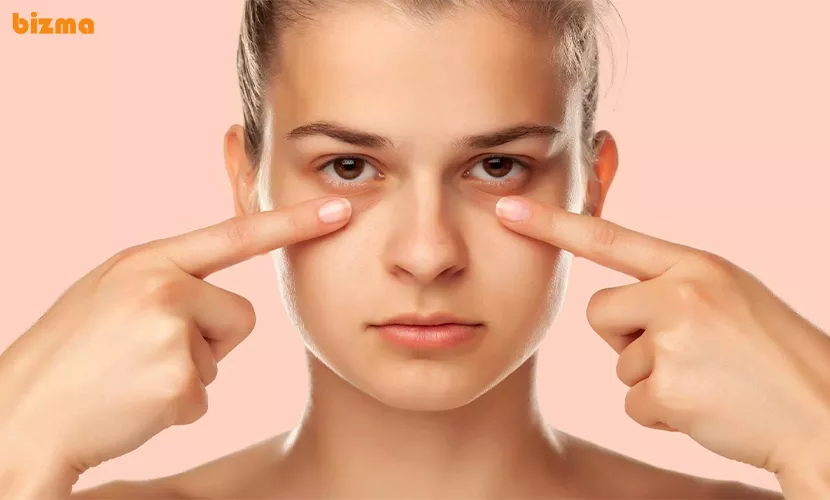 دلایل و درمان پف زیر چشم