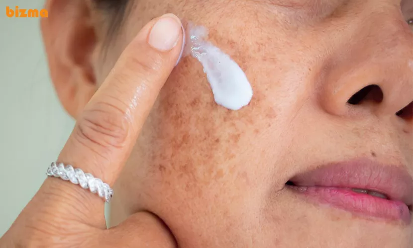 سریع ترین راه از بین بردن لک قهوه ای صورت