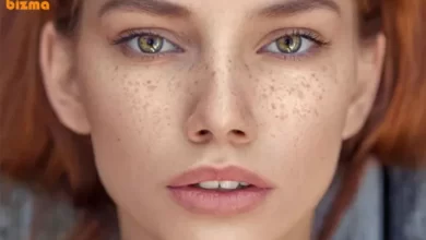 علت لکه های قهوه ای روی صورت و چگونه لکه‌ها را از بین ببریم