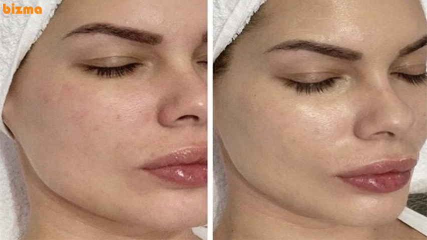 کرم پودر دائم چیست، بررسی هزینه، عوارض و ماندگاری