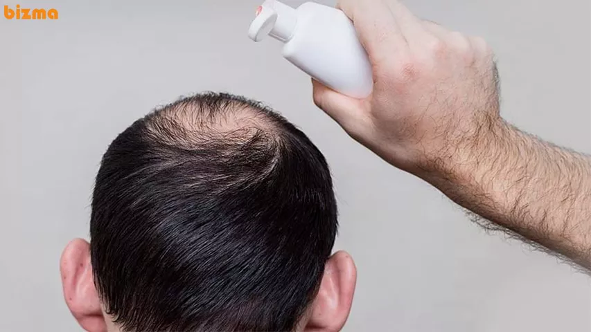 بهترین شامپو ضد ریزش مو آقایان ایرانی 9 طرز استفاده از شامپو ضد ریزش مو