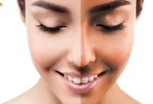 عوارض استفاده از برنز کننده چیست
